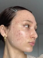 Oil Control Facewash - Tea Tree Oil with Salicylic Acid 2% - Image 3