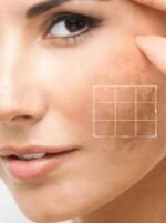 Anti Pigmentation Cream - Image 4