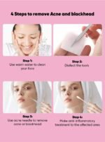 Beautenic Blackhead Remover - Image 3