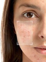 Azelaic Acid 10% + Alpha Arbutin 2% + Licorice 10% Serum - Image 4