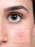 Mendalic Acid 10% + HA 2% Serum - Image 4