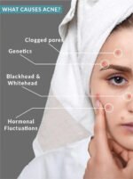 Salicylic Acid 2% Clarifying Toner - Image 4